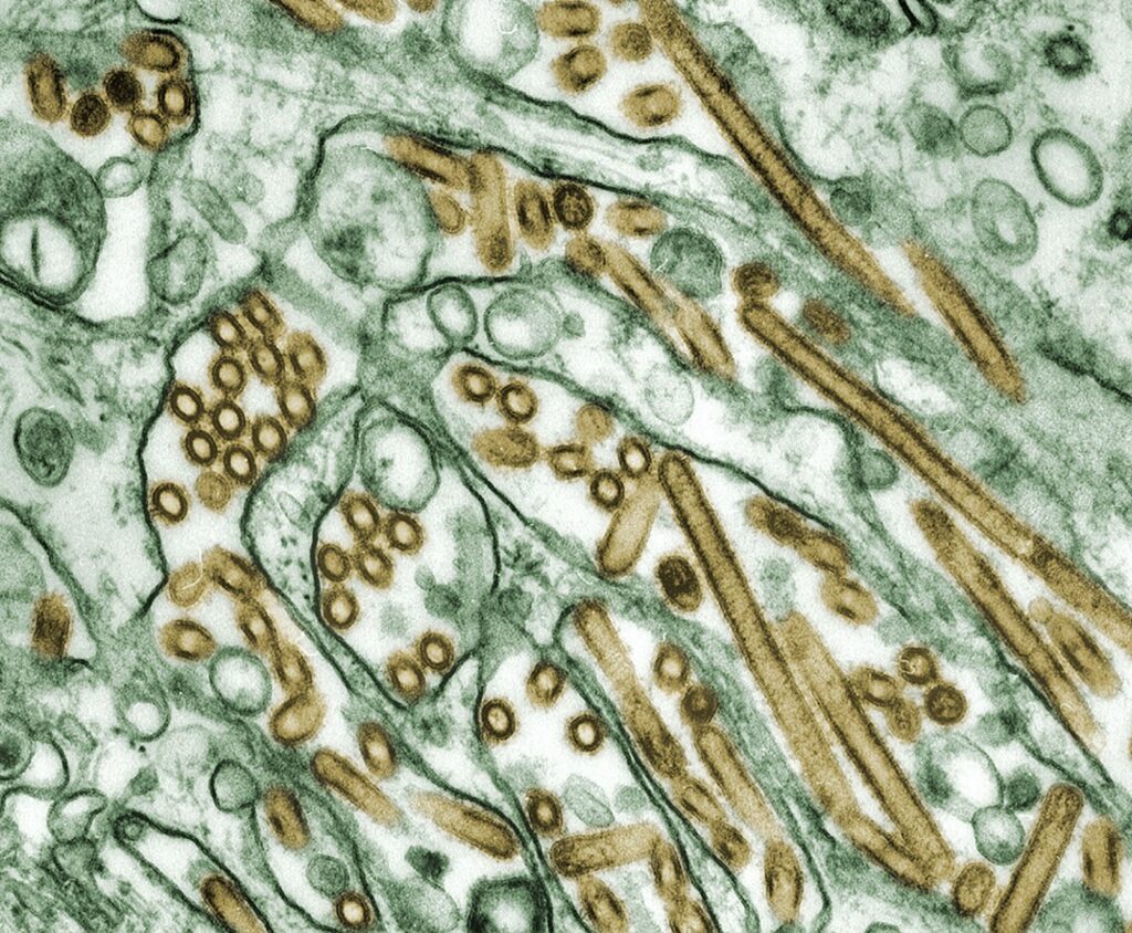 Infecções fúngicas podem variar de simples micoses a quadros sistêmicos sérios. Descubra como os antifúngicos atuam e quais cuidados são necessários.
