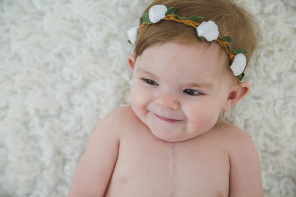 Bebê sorridente com cicatriz cirúrgica no peito, símbolo de superação da cardiopatia congênita