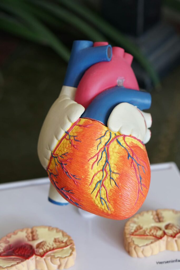 Modelo anatômico de coração com artérias destacadas, representando o sistema cardiovascular e suas doenças, como a insuficiência cardíaca.