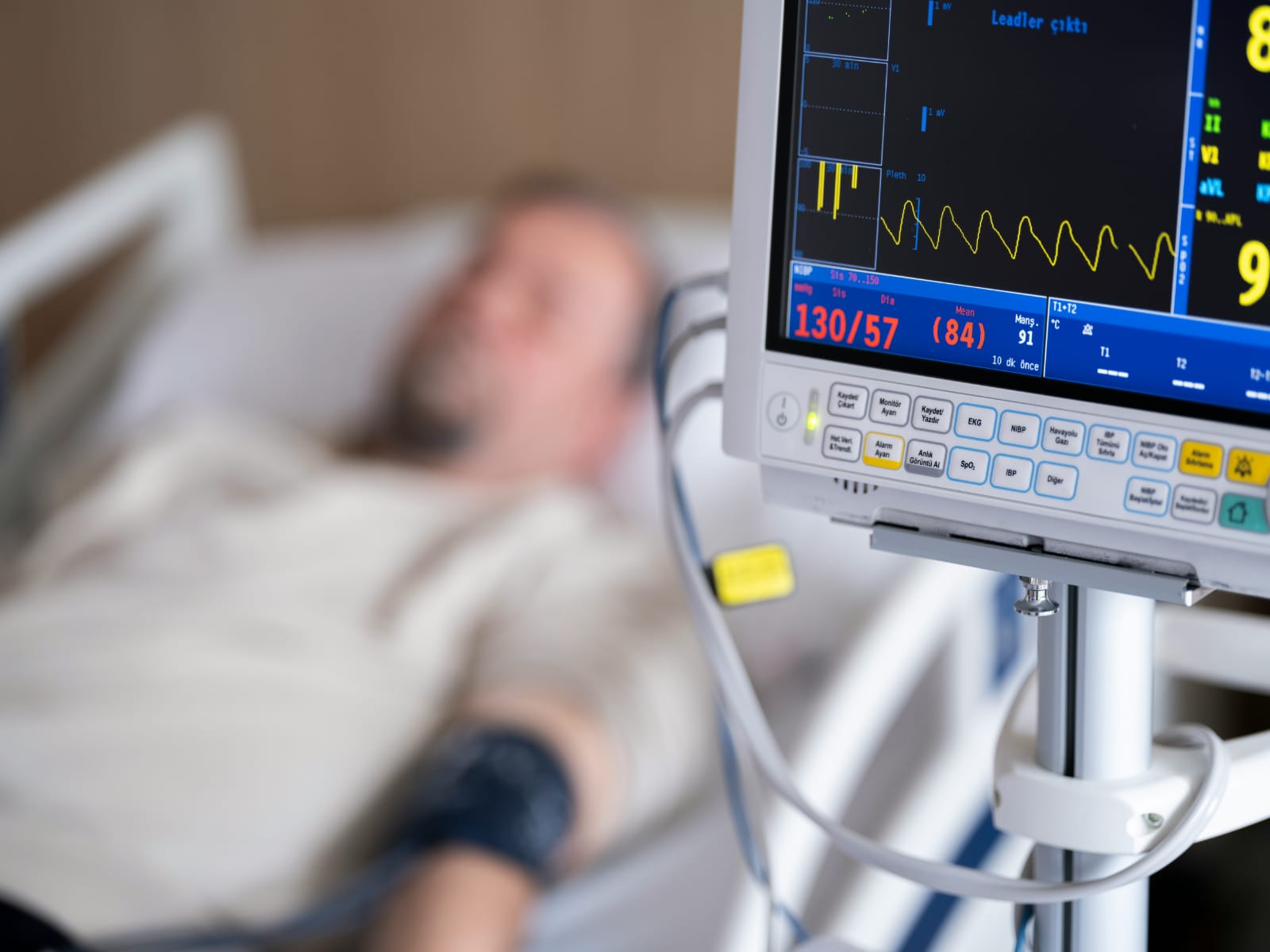 Paciente em hospital monitorado por aparelho de pressão e frequência cardíaca após infarto do miocárdio.