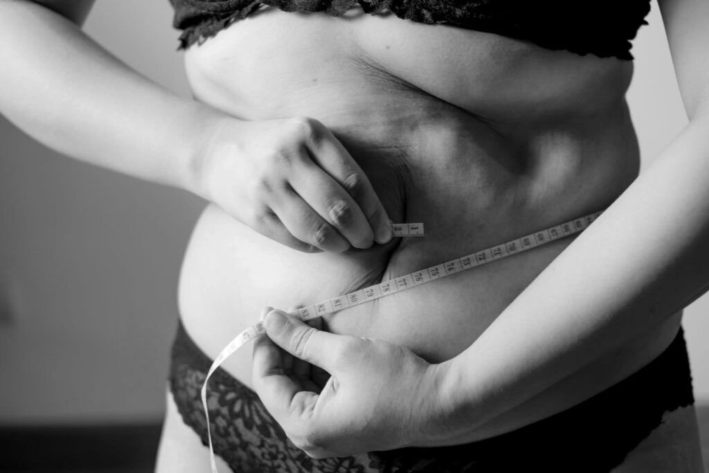 Mulher medindo circunferência abdominal, possível sinal de triglicerides alto.