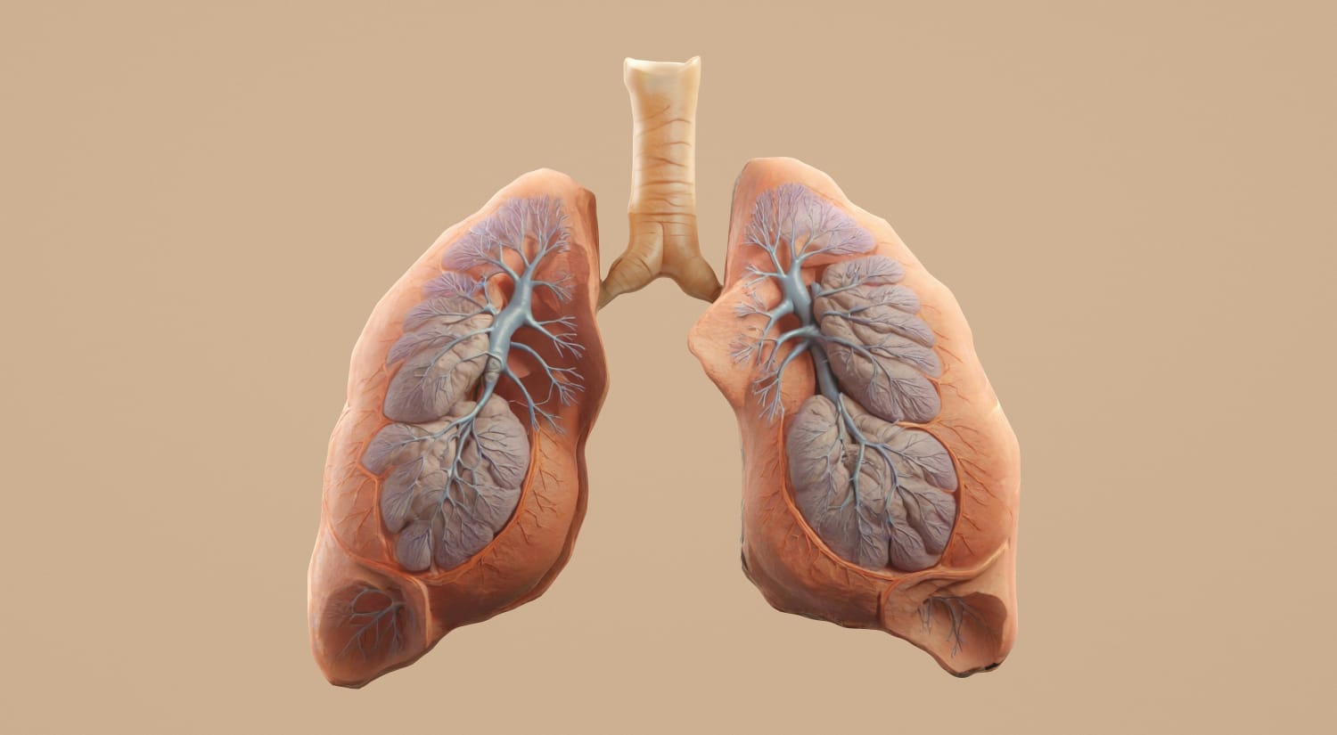 Ilustração anatômica dos pulmões humanos e vasos sanguíneos afetados pela hipertensão pulmonar.