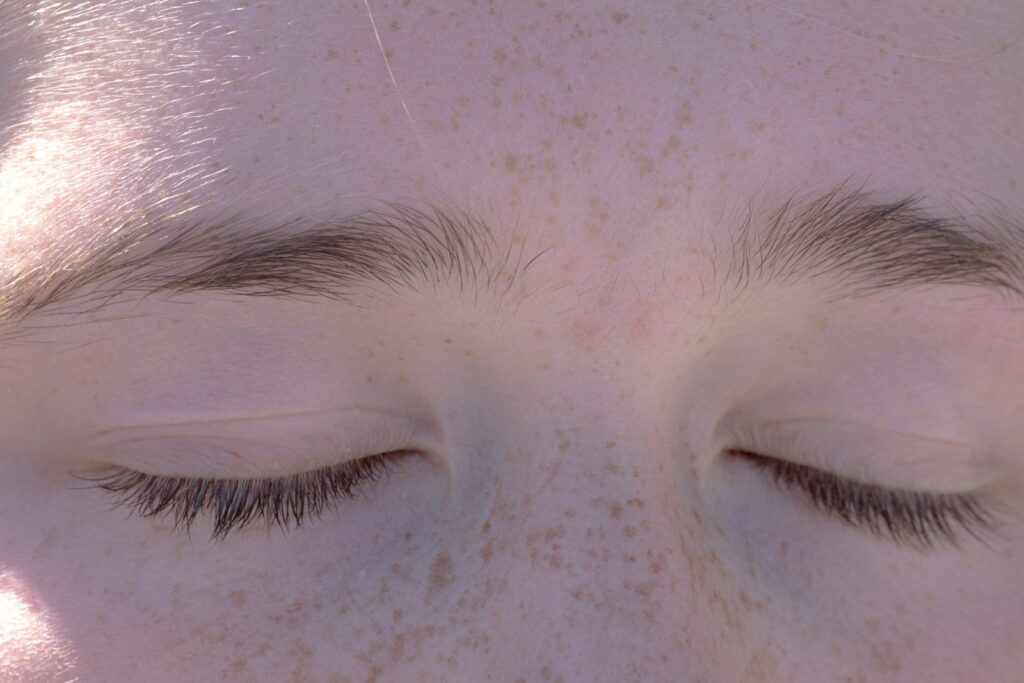 Olhos fechados representando irritação leve e descanso ocular, ilustrando os diferentes tipos de conjuntivite.