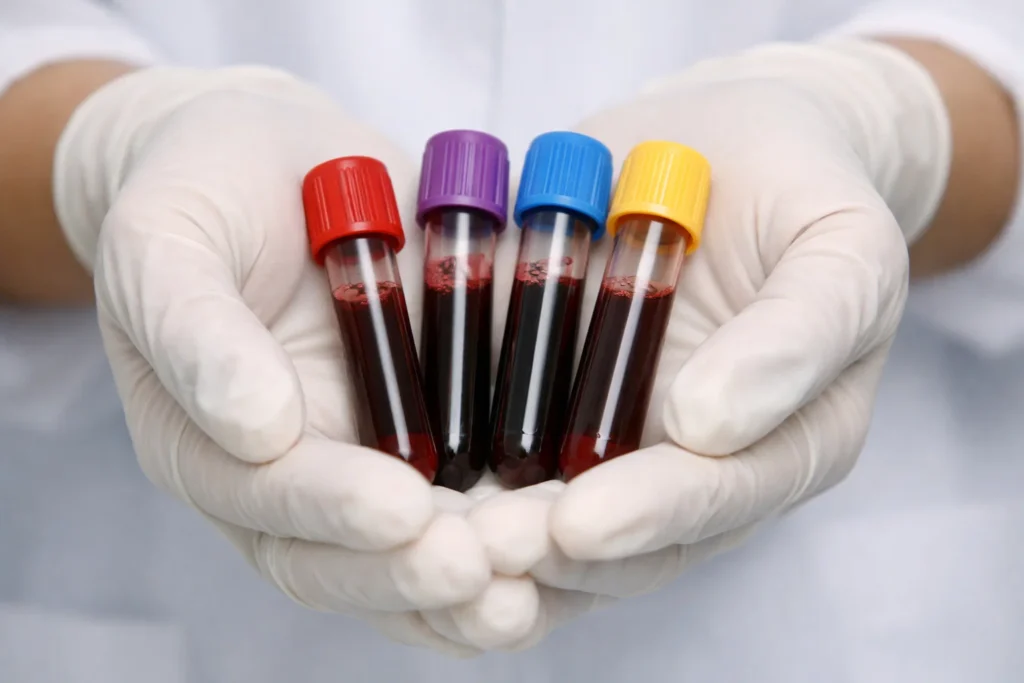 Tubos de ensaio com amostras de sangue para análise de hemograma completo em laboratório.